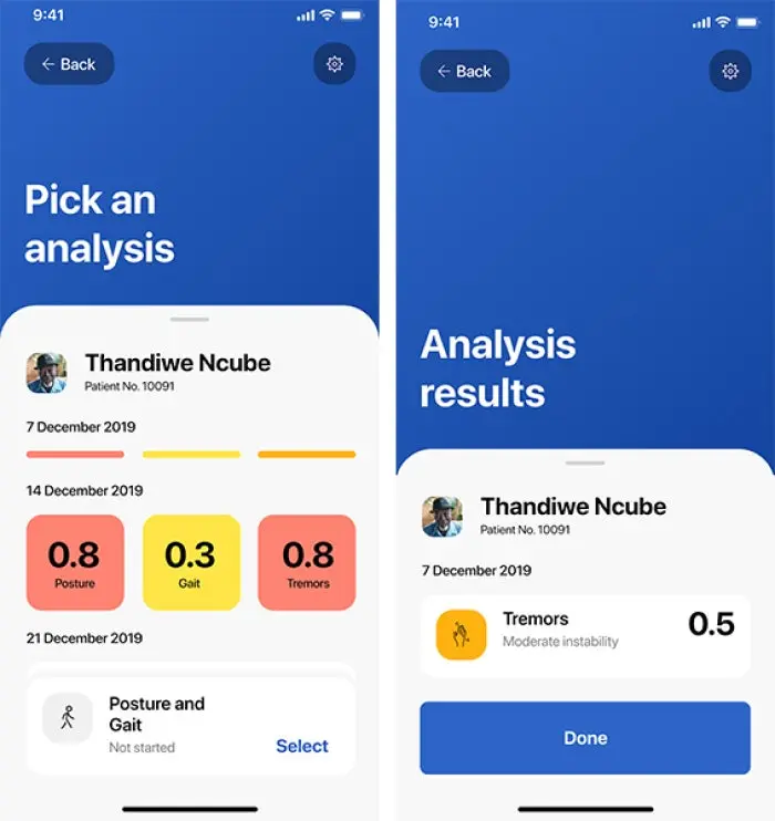 Patana AI app screen with analysis options and patient statistics. Patana AI app screen with tremor analysis results.