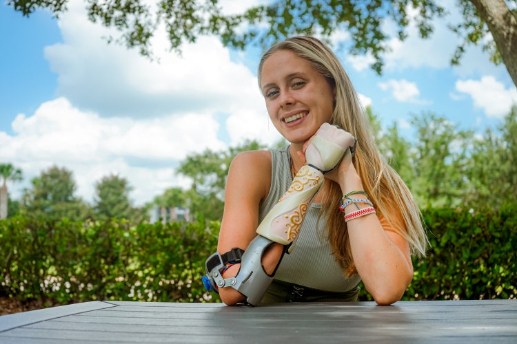 Woman with bionic arm.